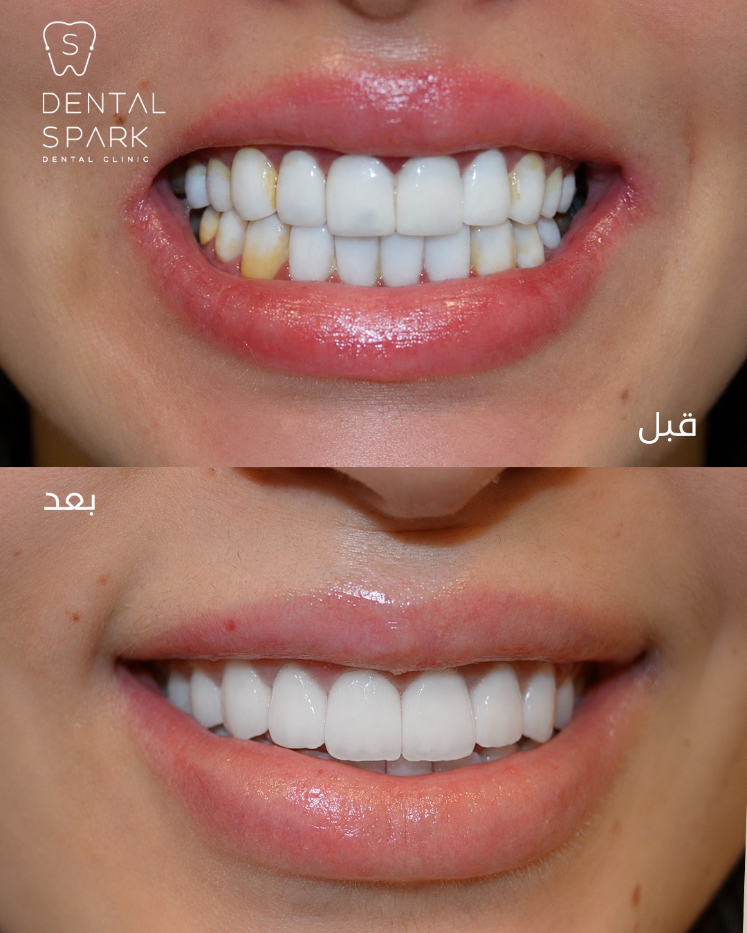 Before and After 5